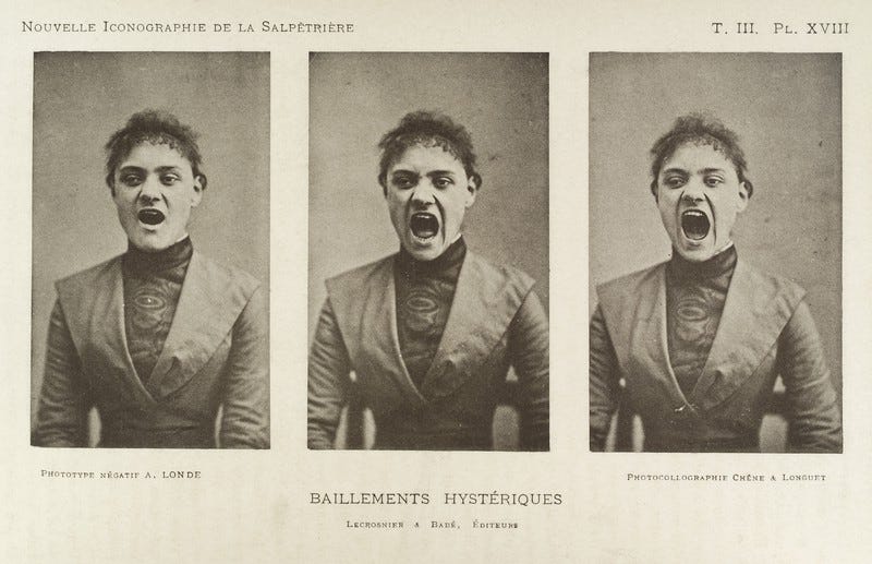 Series of three photos showing a so-called 'hysterical' yawning woman Series of three photos showing a so-called 'hysterical' yawning woman