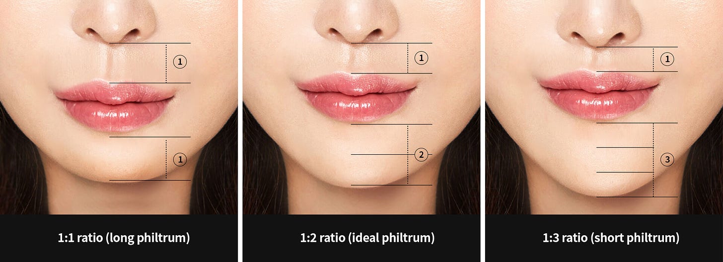 All about philtrum reduction surgery (Upper lip lift) - Hyundai Aesthetics  Blog