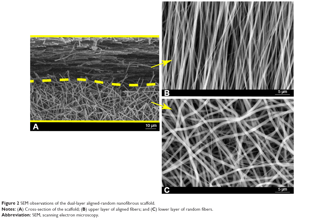Dual-layer aligned-random nanofibrous scaffolds for improving gradient | IJN