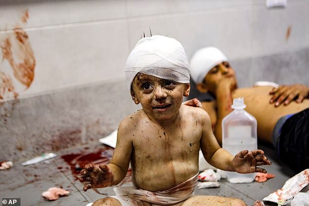 Among those wounded in the explosion were children, women and patients at the hospital. Pictured: A child at al-Shifa hospital after the fireball at al-Ahli hospital