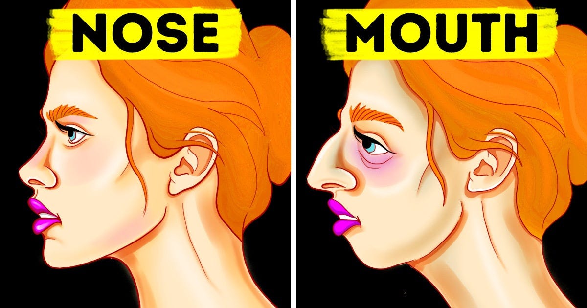 How To Fix Mouth Breather Face (Adenoid Face): Does Mouth Breathing Change  Your Face Shape?