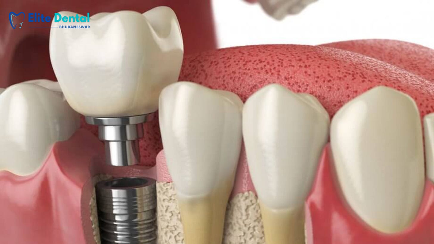Improved Oral Health