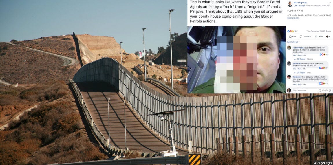 border agent bloody injury after rock thrown on mexican border fake