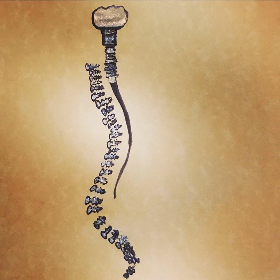 A drawing of a backbone, spinal cord and brain, with the vertebrae and brain represented as titanium screws and a silver tooth cap for the brain. They are outlined in black iron gall.