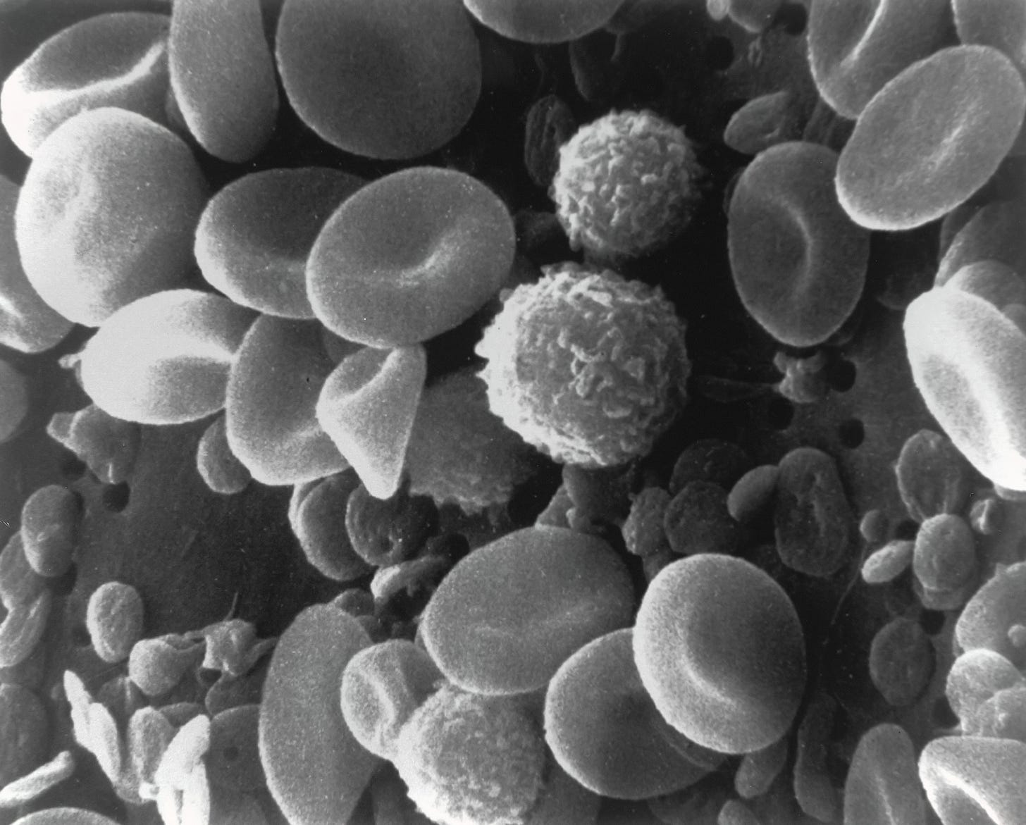 Electron microscope scan of blood, showing a bunch of grayscale blobs.