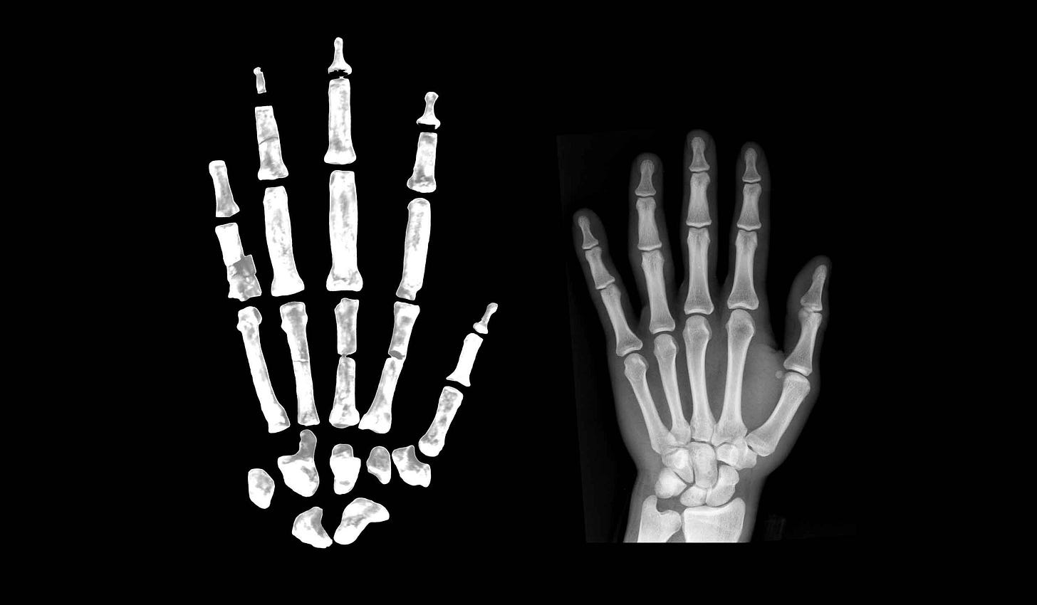Ardipithecus hand skeleton next to a human hand X-ray image Ardipithecus hand skeleton next to a human hand X-ray image