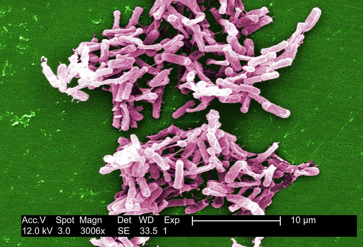 Electron Micrograph Image of C.Diff bacteria