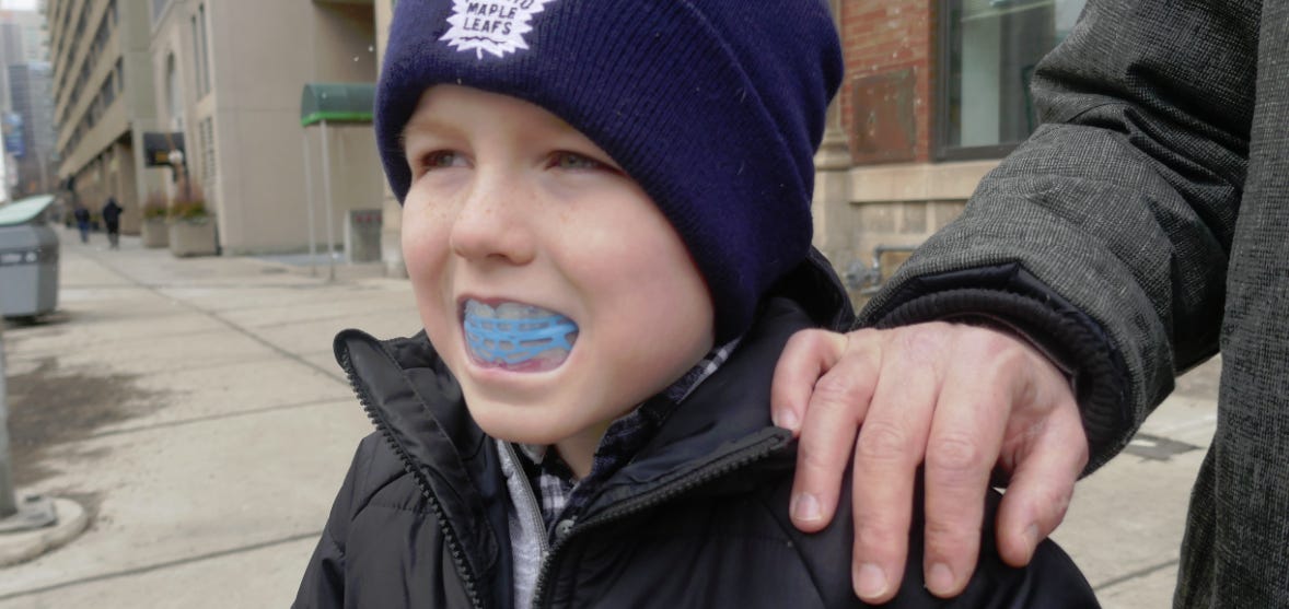 Myobrace in Toronto at Archer Dental - Straighten Childrens' Teeth Without  Braces – Archer Dental