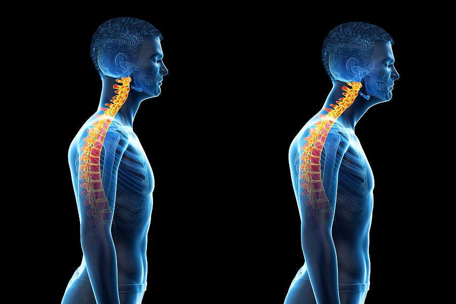 2 Methods You Can Observe To Improve A Forward Head Posture | TakeAseat.sg