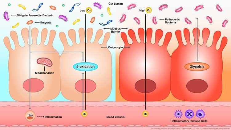 gut diagram