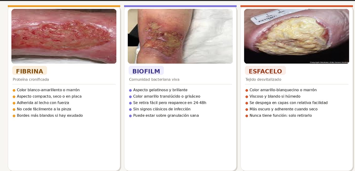 Comparativa fibrina vs esfacelo vs biofilm — características visuales