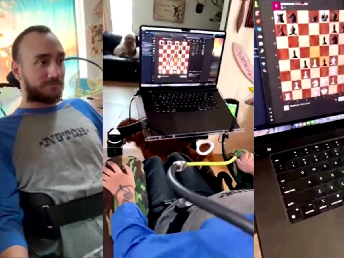 Neuralink mostra 1º paciente com chip cerebral jogando xadrez com a mente |  CNN Brasil