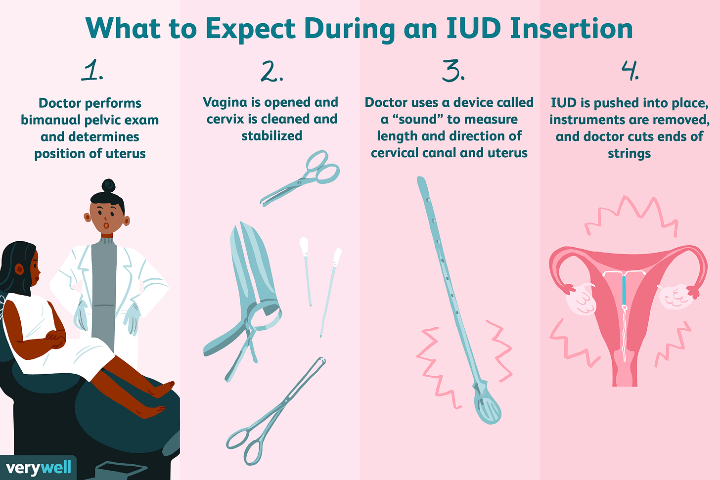 IUD Insertion: What to Expect, Procedure, Protection