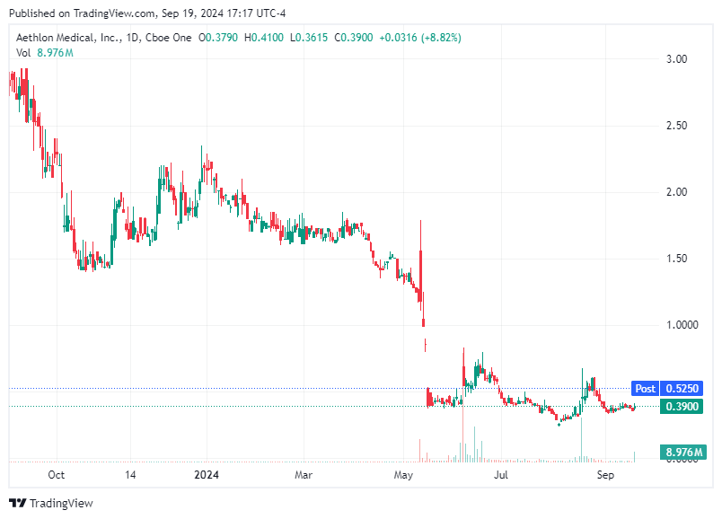 TradingView chart