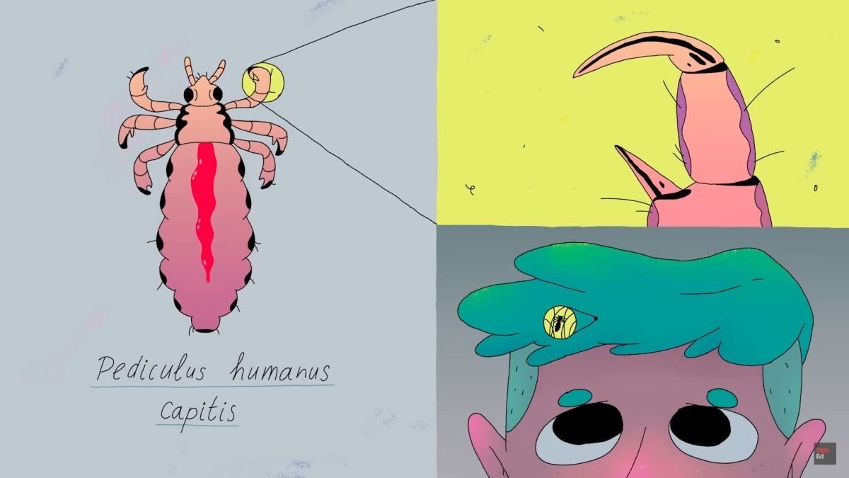 Head Lice