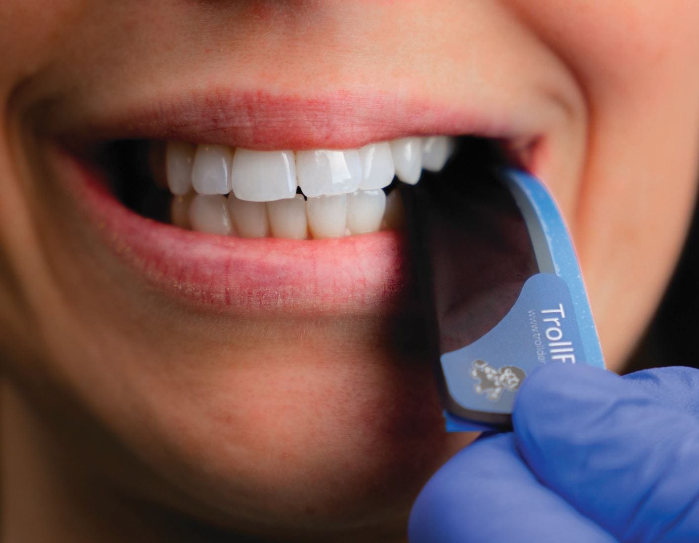 Take the guesswork out of occlusal adjustment | British Dental Journal