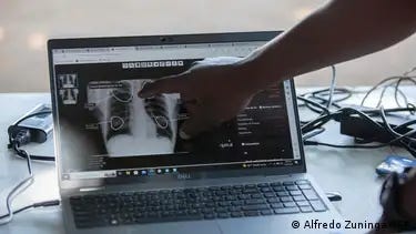 A person points to the results of an X-ray chest examination on a laptop screen