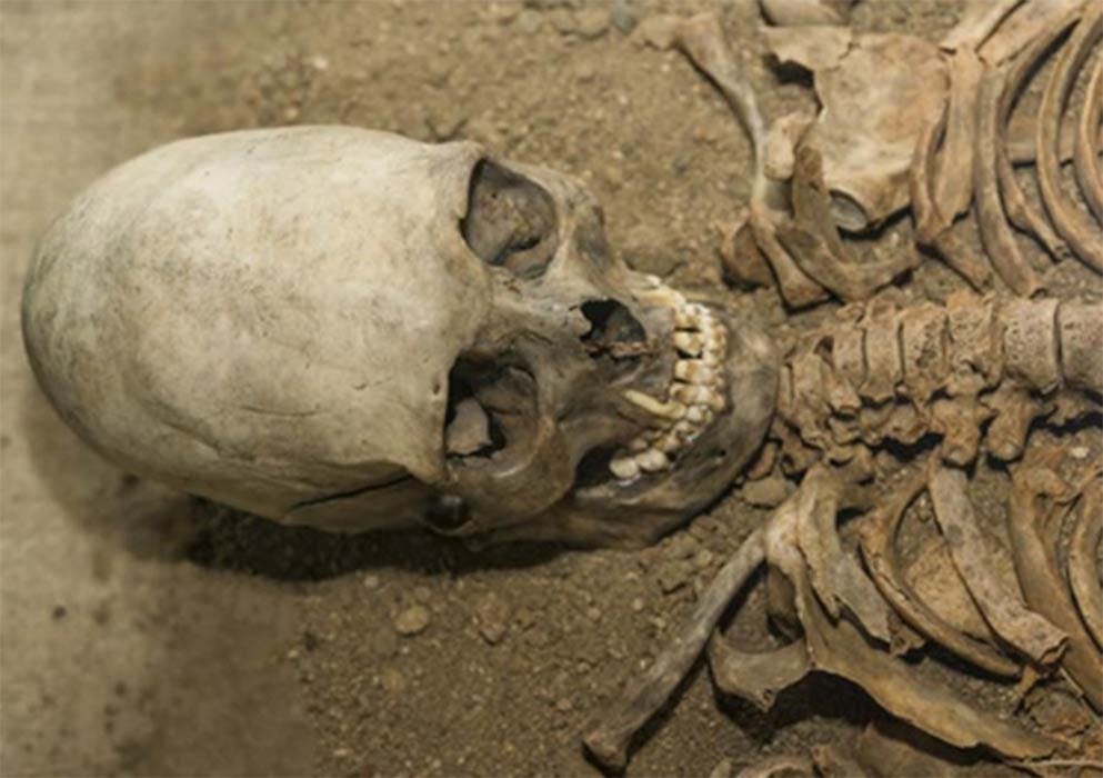 Gods of Antiquity: Elongated Skulls From Africa Https%3A%2F%2Fsubstack-post-media.s3.amazonaws.com%2Fpublic%2Fimages%2Ff90673f1-2ebf-4a7a-9365-a46931e2929c_993x700