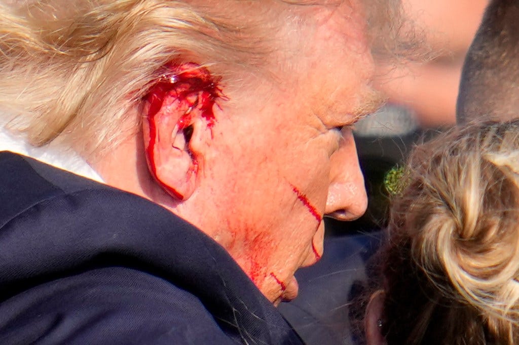 Blood coming from Trump's ear after getting shot.