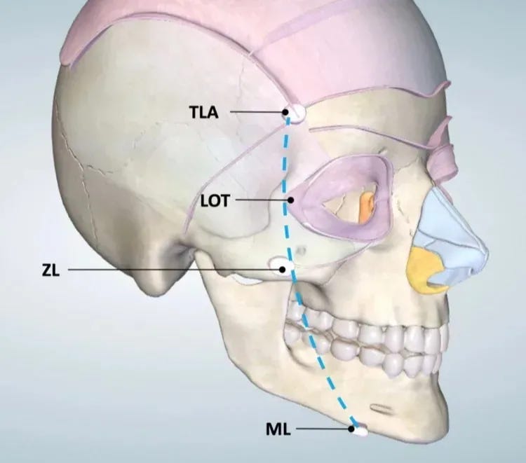 linhas dos ligamentos de cotofana, line of ligaments cotofana linhas dos ligamentos de cotofana, line of ligaments cotofana