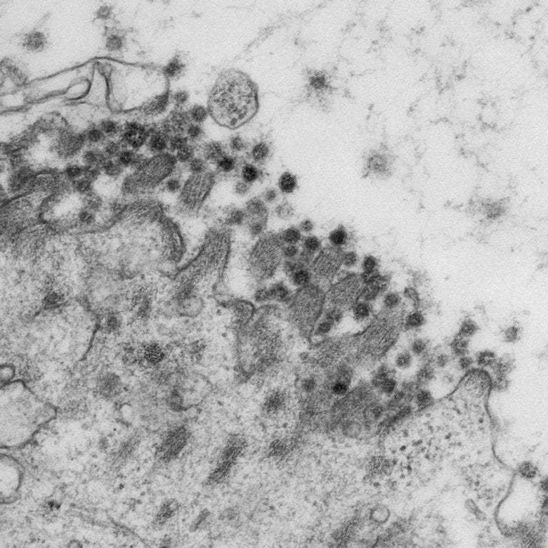 Coronavirus SARS-CoV-2 infects cells of the intestine - Hubrecht Institute