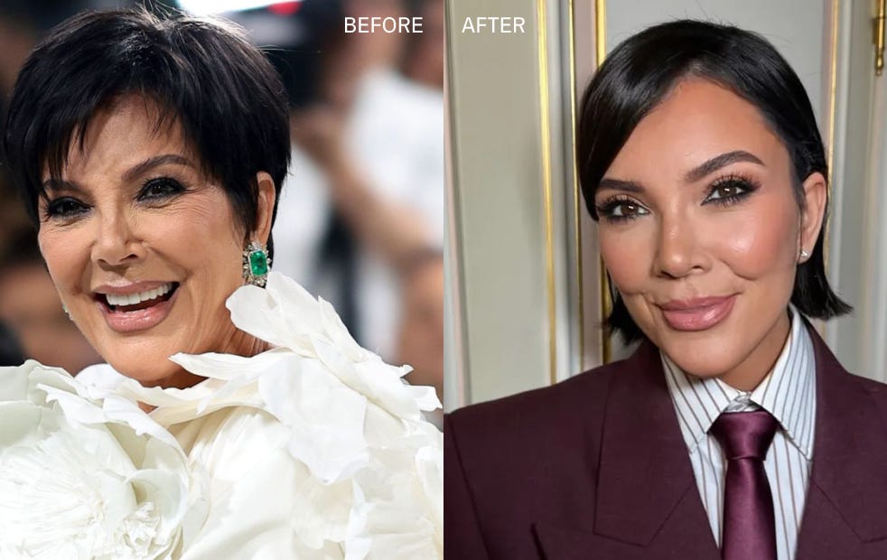 Kris Jenner Just Got a New Face - But This Is the Lift You Actually Want –  BBB London