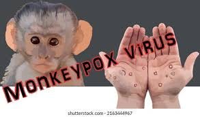 Monkeypox Virus World Health Organization Symptoms Stock Vector (Royalty  Free) 2163444967 | Shutterstock