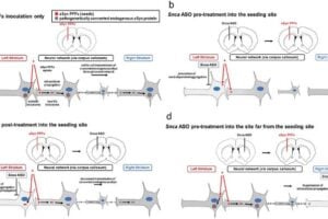 Japanese researchers studied the effects of locally administered ASOs on mouse models of Parkinson's disease. Their research indicates that ASOs can help prevent the formation and spread of harmful alpha-synuclein aggregates in different brain regions, suggesting ASOs as a potential therapeutic strategy for preventing and controlling the progression of neurodegenerative diseases.