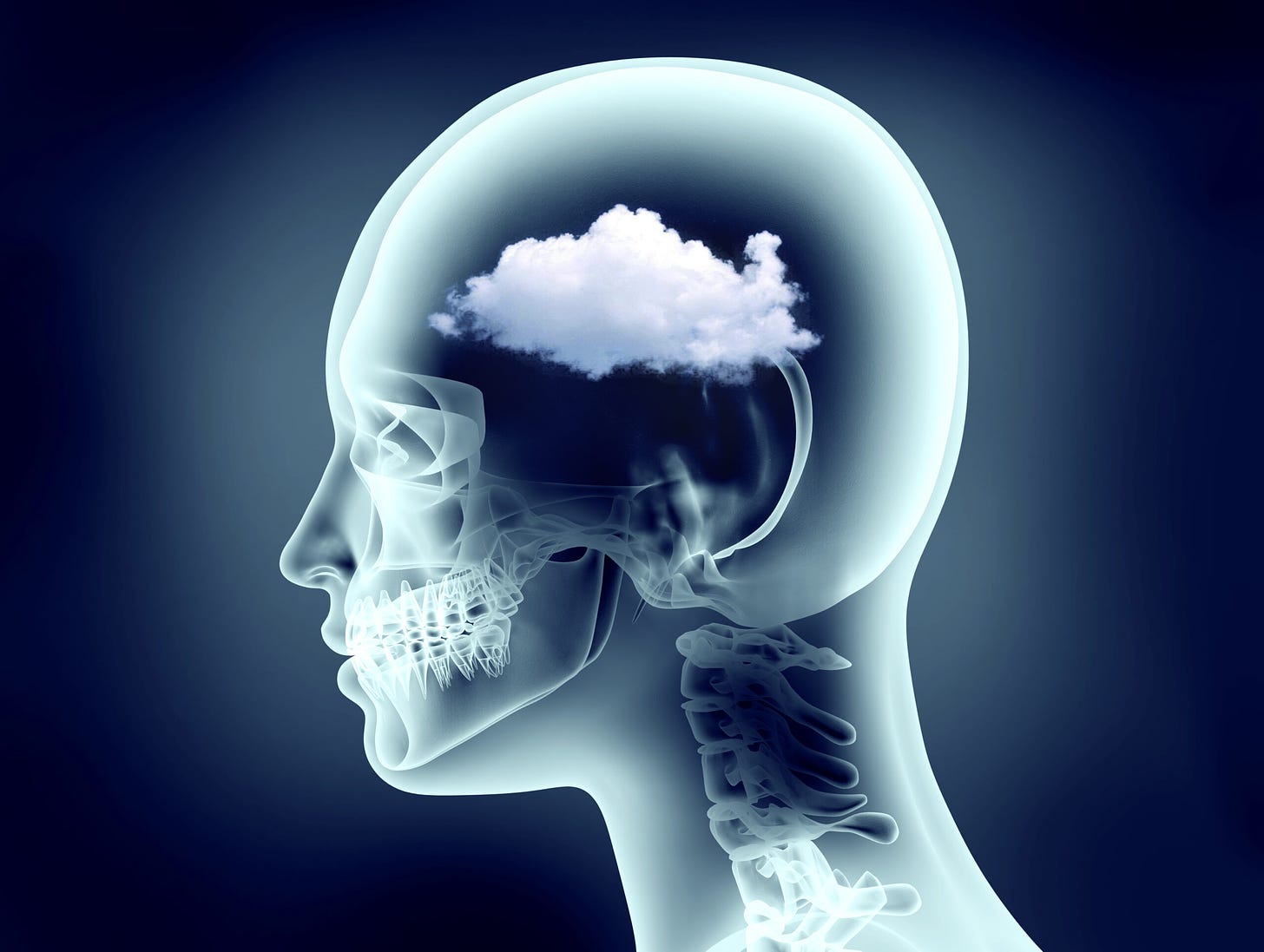 Brain Fog - San Francisco Neuropsychology PC