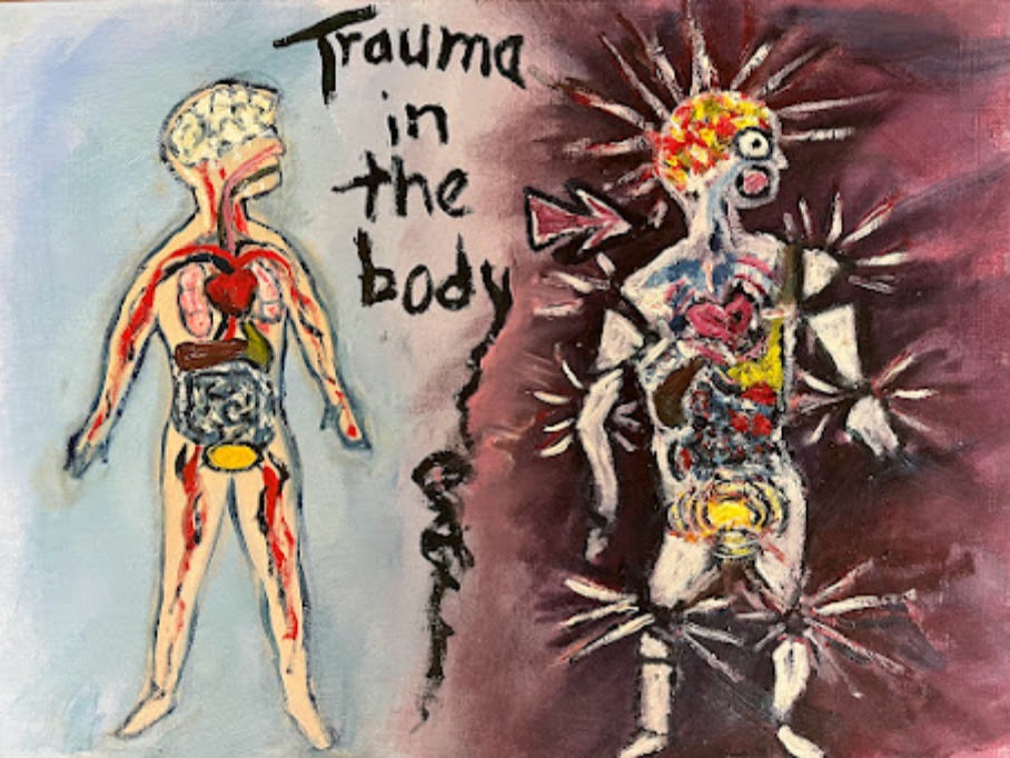 Painting of what a normal body anatomy looks like vs someone stressed out with PTSD. The anatomy of the normal person is fine; the PTSD person is a shattered and shuddering