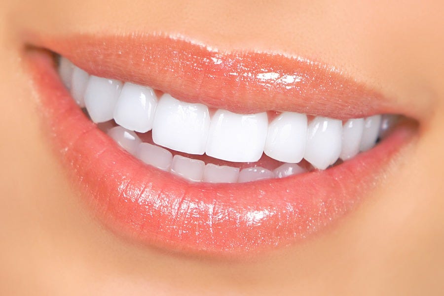 Teeth whitening – the perfect Christmas gift -