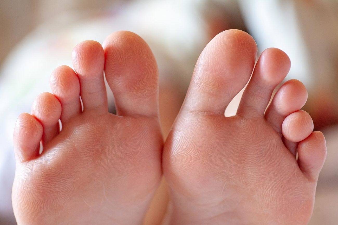 Toe deformities in the small toes – causes, symptoms, diagnosis & treatment