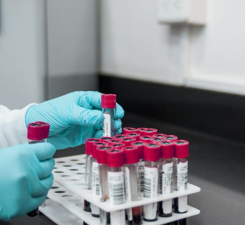 prise de sang cancer du pancreas