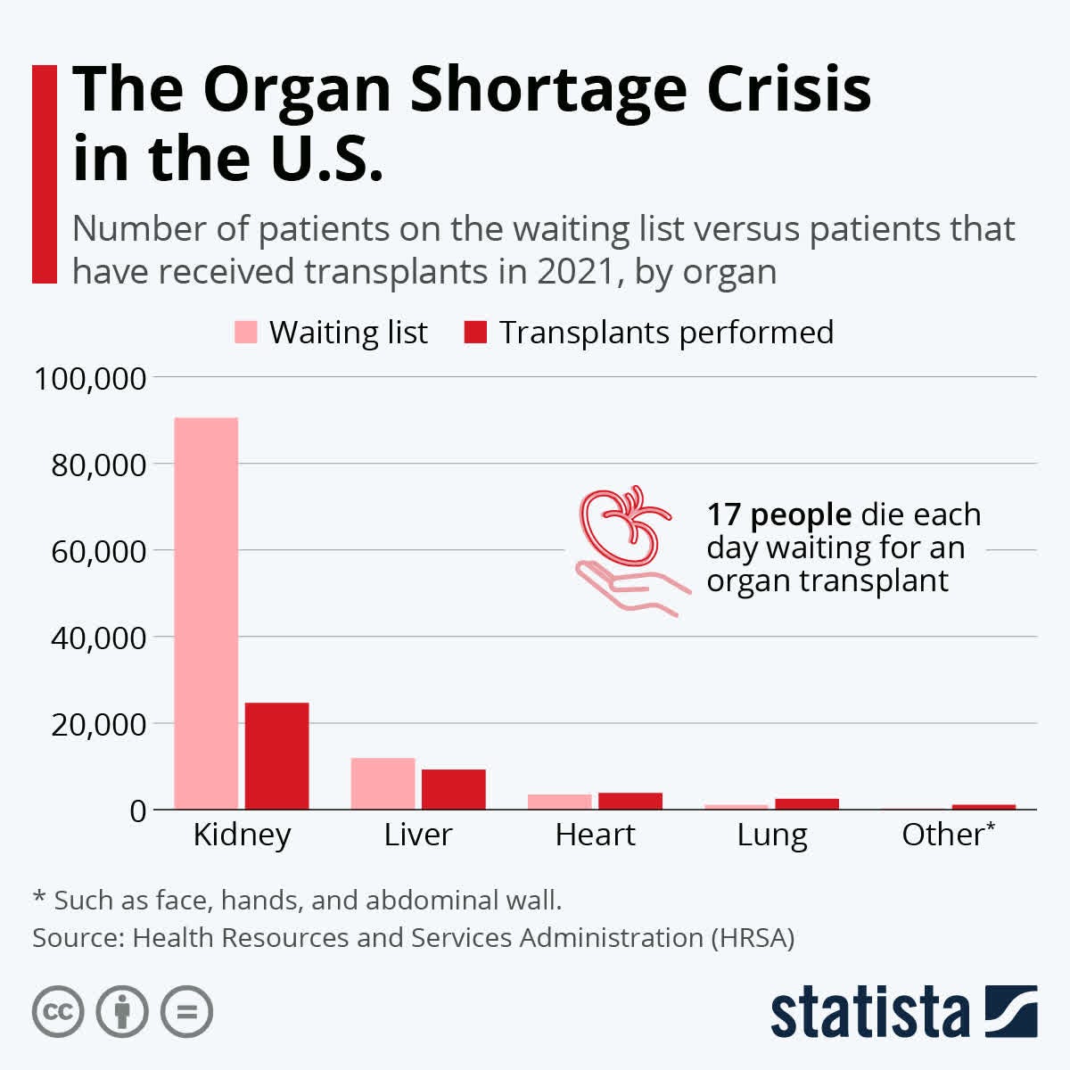 Chart: The Organ Shortage Crisis in the U.S. | Statista