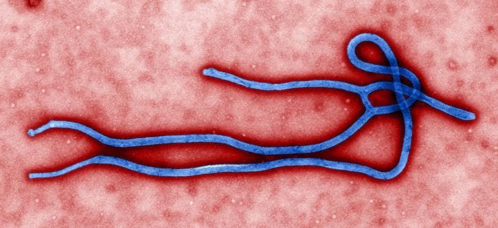 ultra-estruturais, morfologia, ebola, vírus vírion