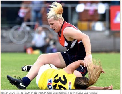 Hannah Mouncey is a huge trans women who has competed on female sports teams