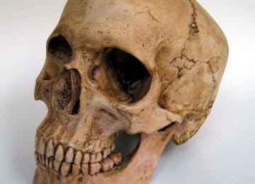 Ancient Skull Unearthed in Tehran | Financial Tribune