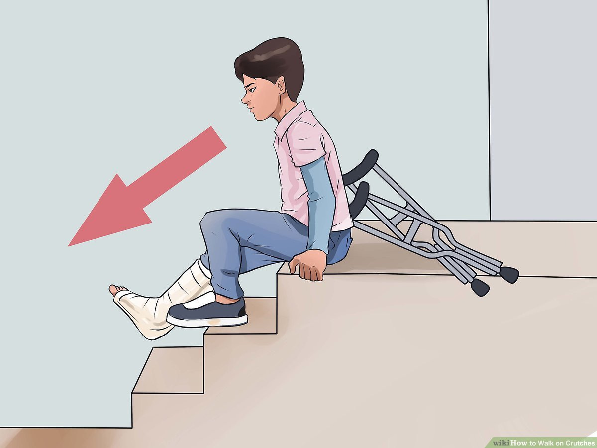 How to Walk on Crutches: Tips on Correct Hold, Gait, Stairs & Sitting