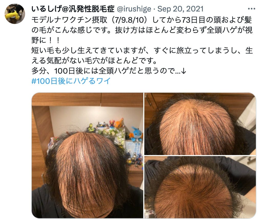 73rd day after vaccination. (irushige/Twitter)
