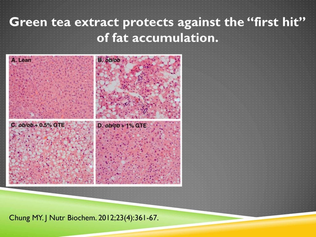 9. Oxidative Stress, Green Tea, and Fatty Liver Disease