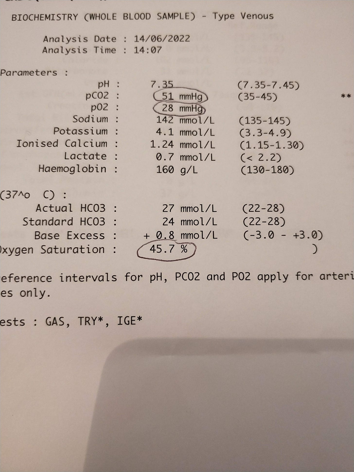 How I recovered from Long Covid using venous blood gas testing. How I recovered from Long Covid using venous blood gas testing.