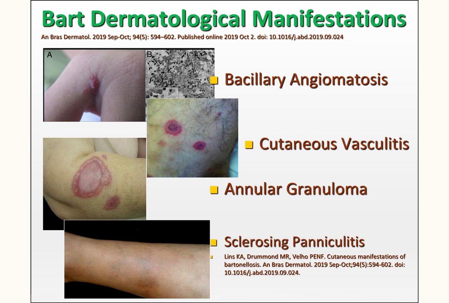 MEDICAL DETECTIVE: Establishing the diagnosis of Bartonella