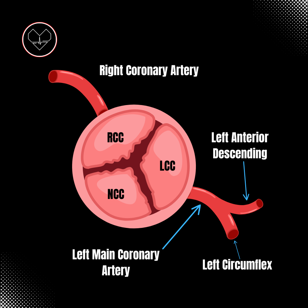What Anomalous Coronary Arteries Seen With Echo