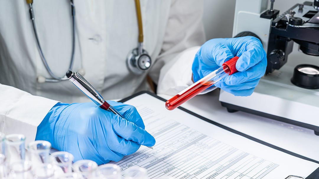 COVID19, Vaccination, and HIV False Positivity An Examination of