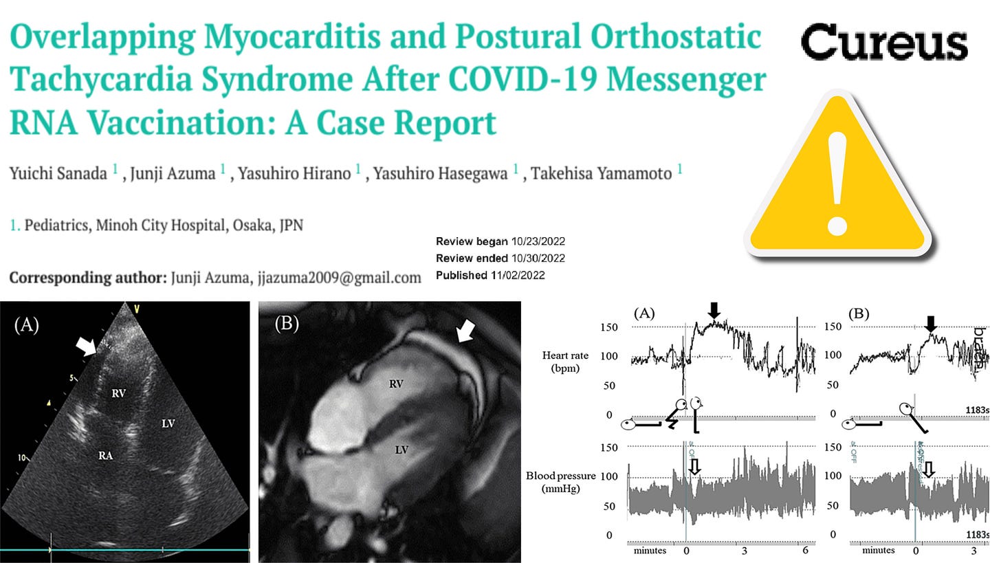 Severe and overlapping pots with myocarditis after a 2nd dose of pfizer 039 s covid 19 vaccine in a healthy 13 year old child with debilitating symptoms lasting over 7 months