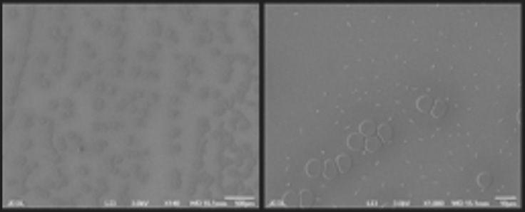Electron Microscopy Of The Blood Of A 43 Year Old With 3 Pfizer ...