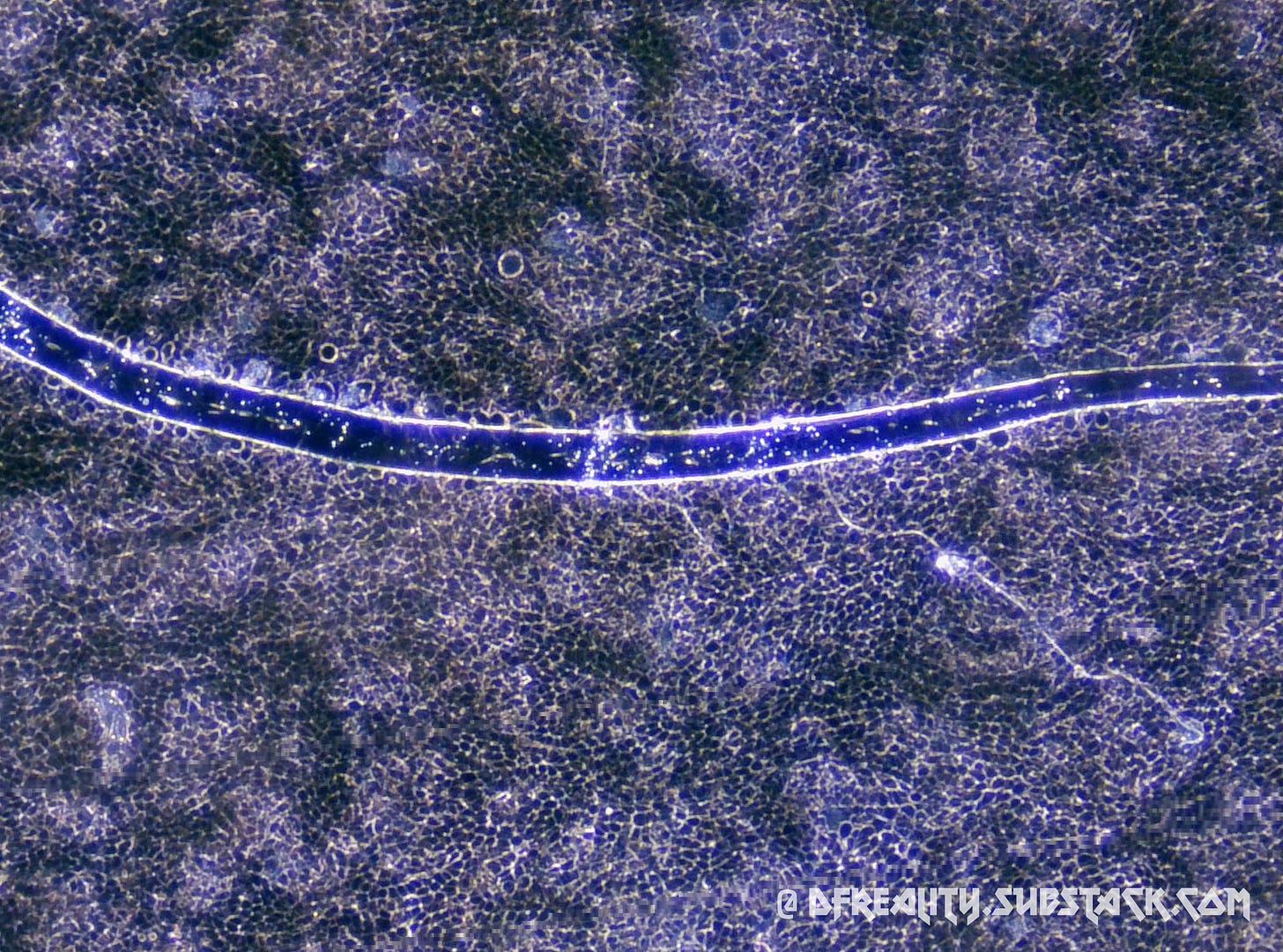 The Forced Evolution of Humanity: FIRST-HAND EVIDENCE of nanotechnology ...