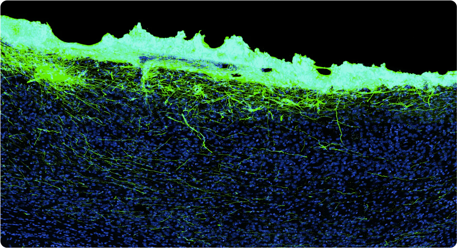 Science Corp. Explains How Its Biohybrid Neural Interfaces Work