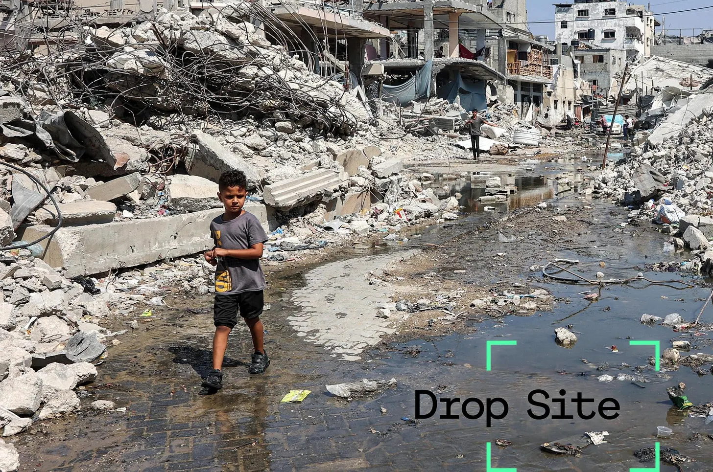 Survivors of Israeli Bombardment Face New Catastrophe: Epidemics, Amputations, Starvation