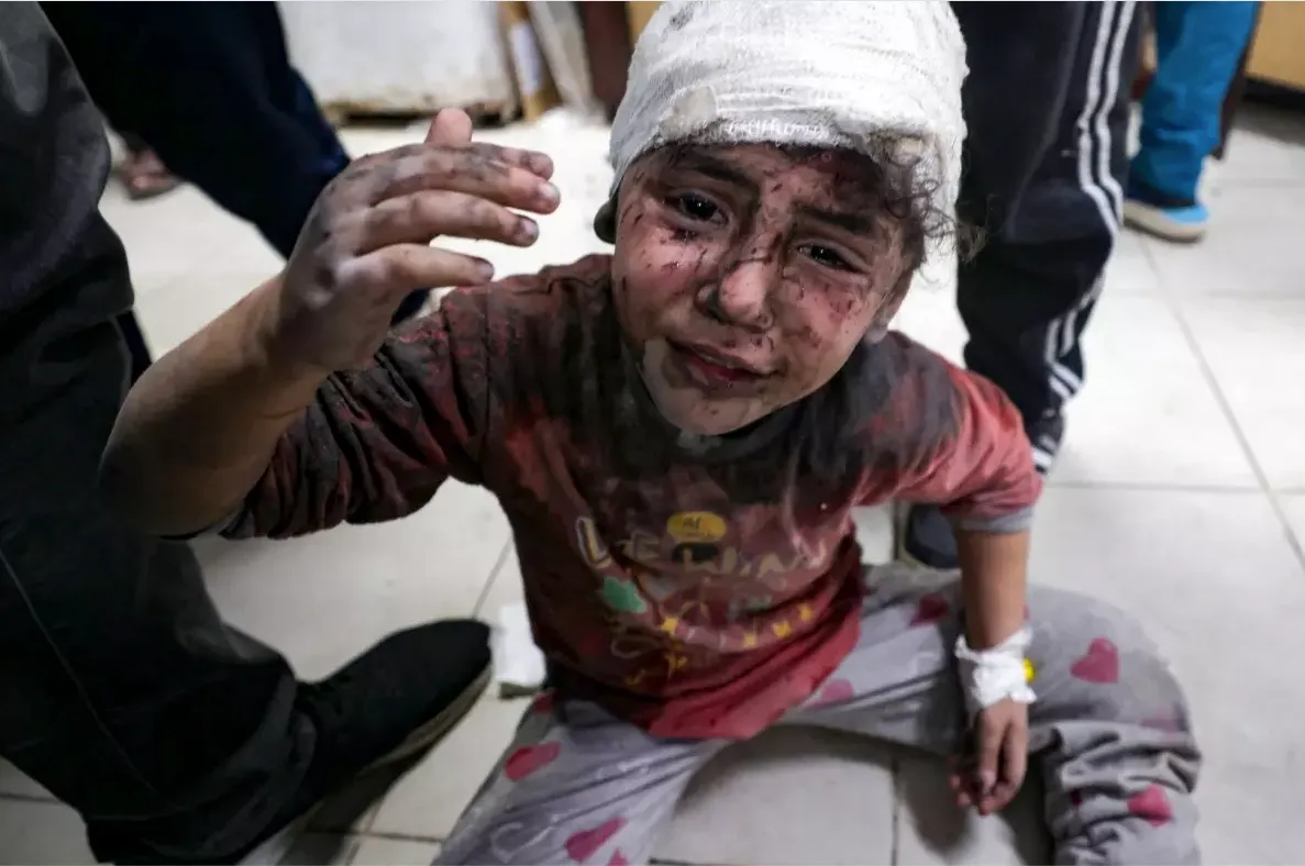 Photo of young victim of war